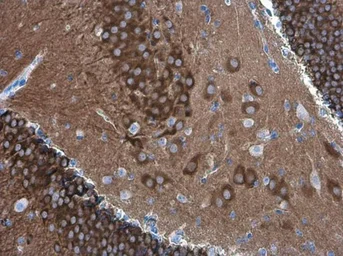 Anti-PYK2 antibody [GT1132] used in IHC (Paraffin sections) (IHC-P). GTX633918