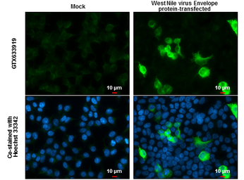 Anti-West Nile virus Envelope antibody [GT3029] used in Immunocytochemistry/ Immunofluorescence (ICC/IF). GTX633919