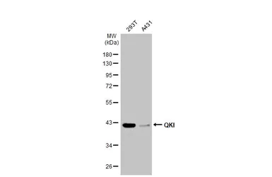 Anti-QKI antibody [GT2612] used in Western Blot (WB). GTX633921