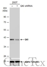 Anti-QKI antibody [GT228] used in Western Blot (WB). GTX633922