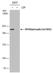 Anti-MYH9 (phospho Ser1943) antibody [GT144] used in Western Blot (WB). GTX633955