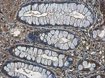 Anti-MYH9 (phospho Ser1943) antibody [GT144] used in IHC (Paraffin sections) (IHC-P). GTX633955