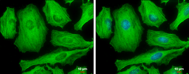 Anti-MYH9 (phospho Ser1943) antibody [GT144] used in Immunocytochemistry/ Immunofluorescence (ICC/IF). GTX633955