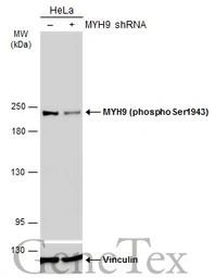 Anti-MYH9 (phospho Ser1943) antibody [GT144] used in Western Blot (WB). GTX633955
