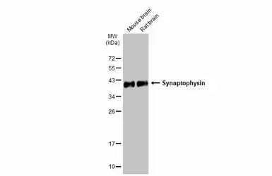 Anti-Synaptophysin antibody [GT2589] used in Western Blot (WB). GTX633972