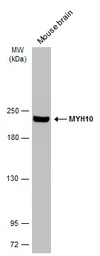 Anti-MYH10 antibody [GT324] used in Western Blot (WB). GTX634139
