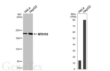 Anti-MYH10 antibody [GT246] used in Western Blot (WB). GTX634160
