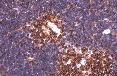 Anti-PYK2 antibody [GT858] used in IHC (Paraffin sections) (IHC-P). GTX634162