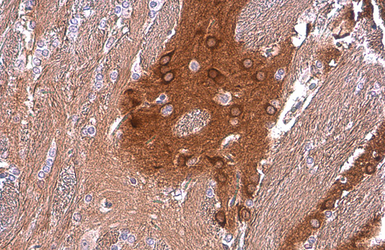 Anti-PYK2 antibody [GT858] used in IHC (Paraffin sections) (IHC-P). GTX634162