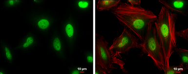 Anti-Cullin 4a antibody [GT2435] used in Immunocytochemistry/ Immunofluorescence (ICC/IF). GTX634165