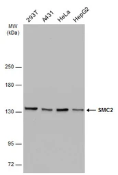 Anti-SMC2 antibody [GT4312] used in Western Blot (WB). GTX634171
