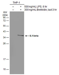 Anti-IL1 beta antibody [GT289] used in Western Blot (WB). GTX634188