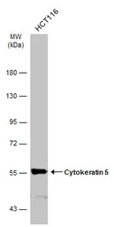 Anti-Cytokeratin 5 antibody [GT1486] used in Western Blot (WB). GTX634308