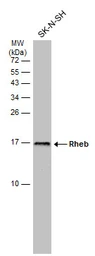Anti-Rheb antibody [GT39810] used in Western Blot (WB). GTX634335