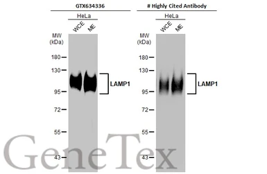 Anti-LAMP1 antibody [GT25212] used in Western Blot (WB). GTX634336