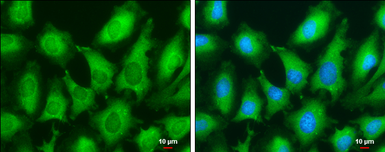 Anti-Human Papillomavirus type 18 E7 antibody [GT881] used in Immunocytochemistry/ Immunofluorescence (ICC/IF). GTX634337