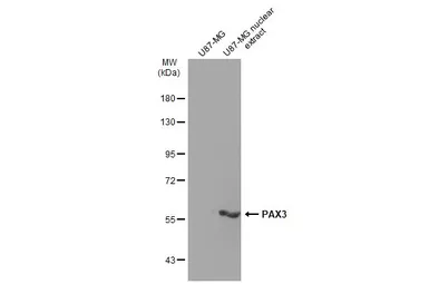 Anti-PAX3 antibody [GT1210] used in Western Blot (WB). GTX634390
