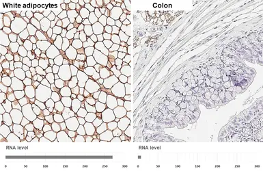 Anti-Perilipin 1 antibody [GT2781] used in IHC (Paraffin sections) (IHC-P). GTX634406