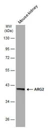 Anti-ARG2 antibody [GT11111] used in Western Blot (WB). GTX634415