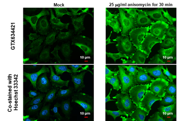 Anti-HSP27 (phospho Ser82) antibody [GT357] used in Immunocytochemistry/ Immunofluorescence (ICC/IF). GTX634421