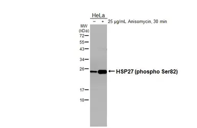 Anti-HSP27 (phospho Ser82) antibody [GT357] used in Western Blot (WB). GTX634421