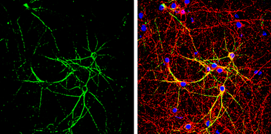 Anti-MAP2 antibody [GT925] used in Immunocytochemistry/ Immunofluorescence (ICC/IF). GTX634473
