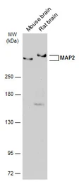 Anti-MAP2 antibody [GT925] used in Western Blot (WB). GTX634473
