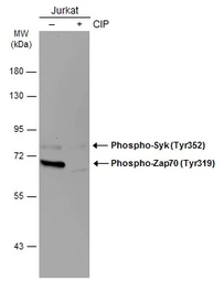 Anti-ZAP70 (phospho Tyr319) / Syk (phospho Tyr352) antibody [GT364] used in Western Blot (WB). GTX634476