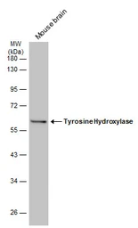 Anti-Tyrosine Hydroxylase antibody [GT234] used in Western Blot (WB). GTX634481