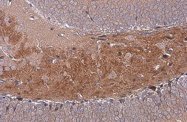 Anti-C9orf72 antibody [GT1553] used in IHC (Paraffin sections) (IHC-P). GTX634482