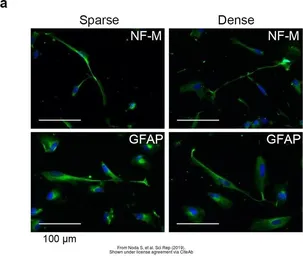 Anti-NF-M antibody [GT883] used in Immunocytochemistry/ Immunofluorescence (ICC/IF). GTX634483