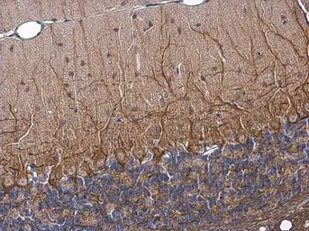 Anti-NF-M antibody [GT883] used in IHC (Paraffin sections) (IHC-P). GTX634483