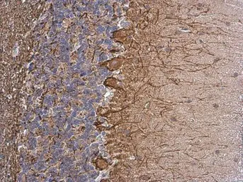Anti-NF-M antibody [GT883] used in IHC (Paraffin sections) (IHC-P). GTX634483