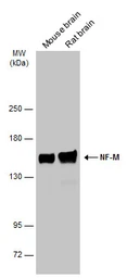 Anti-NF-M antibody [GT883] used in Western Blot (WB). GTX634483