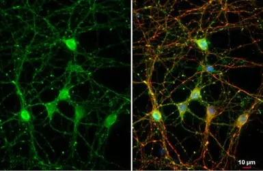 Anti-NF-M antibody [GT883] used in Immunocytochemistry/ Immunofluorescence (ICC/IF). GTX634483