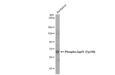 Anti-ZAP70 (phospho Tyr319) / Syk (phospho Tyr352) antibody [GT1686] used in Western Blot (WB). GTX634484