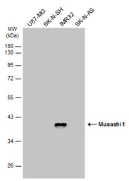 Anti-Musashi 1 antibody [GT2377] used in Western Blot (WB). GTX634485