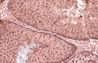 Anti-Vinculin antibody [GT3210] used in IHC (Paraffin sections) (IHC-P). GTX634535