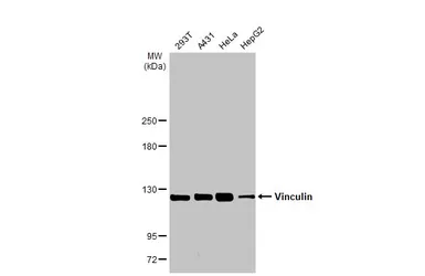 Anti-Vinculin antibody [GT3210] used in Western Blot (WB). GTX634535
