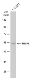 Anti-MMP1 antibody [GT2649] used in Western Blot (WB). GTX634538