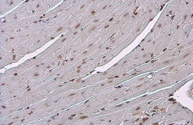 Anti-Glucocorticoid Receptor antibody [GT248] used in IHC (Paraffin sections) (IHC-P). GTX634647