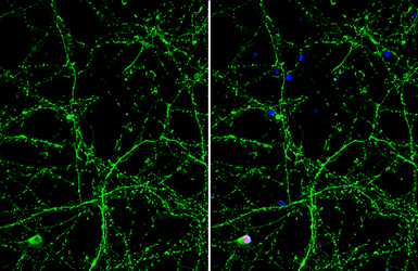 Anti-OTUB1 antibody [GT611] used in Immunocytochemistry/ Immunofluorescence (ICC/IF). GTX634648