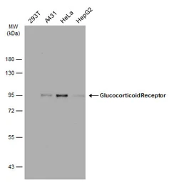 Anti-Glucocorticoid Receptor antibody [GT1073] used in Western Blot (WB). GTX634705
