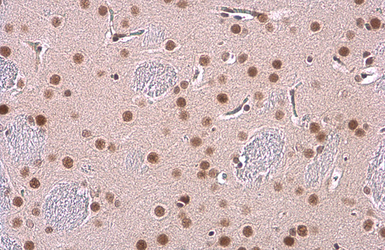 Anti-Glucocorticoid Receptor antibody [GT1073] used in IHC (Paraffin sections) (IHC-P). GTX634705
