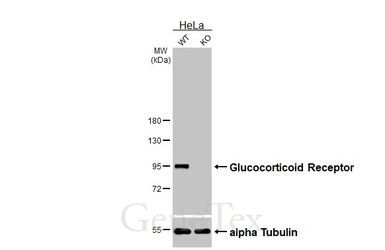 Anti-Glucocorticoid Receptor antibody [GT1073] used in Western Blot (WB). GTX634705