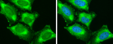 Anti-SH3GL1 antibody [GT3065] used in Immunocytochemistry/ Immunofluorescence (ICC/IF). GTX634708
