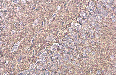 Anti-NCAM antibody [GT135] used in IHC (Paraffin sections) (IHC-P). GTX634792