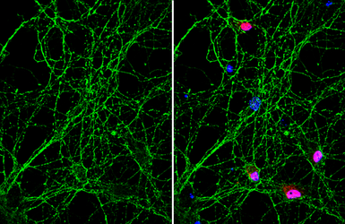 Anti-NCAM antibody [GT135] used in Immunocytochemistry/ Immunofluorescence (ICC/IF). GTX634792