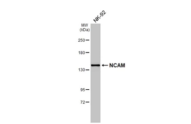 Anti-NCAM antibody [GT135] used in Western Blot (WB). GTX634792