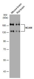 Anti-NCAM antibody [GT249] used in Western Blot (WB). GTX634807